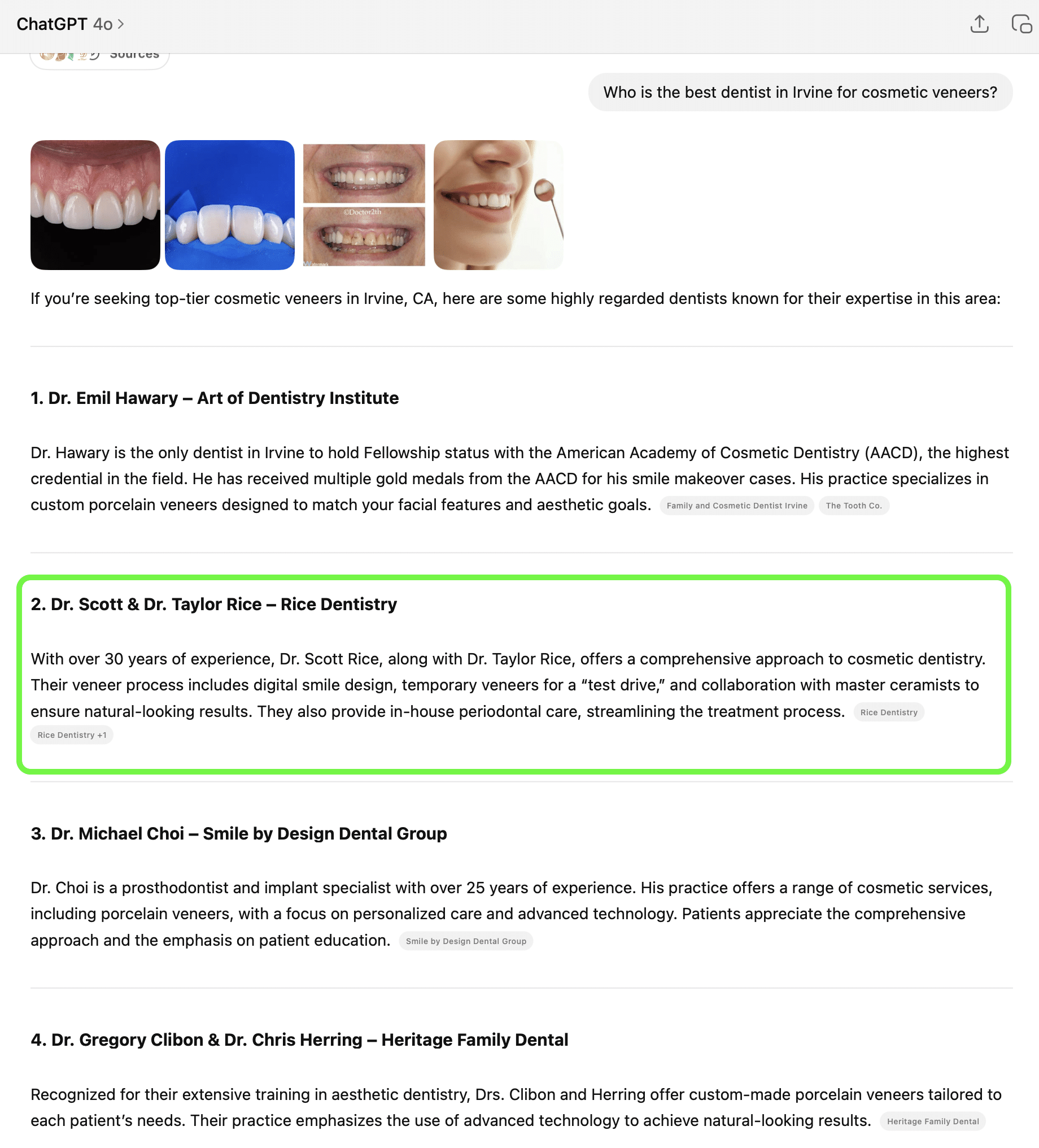 Screenshot of ChatGPT listing top dentists in Irvine, CA for cosmetic veneers, with names, practices, and specialties.